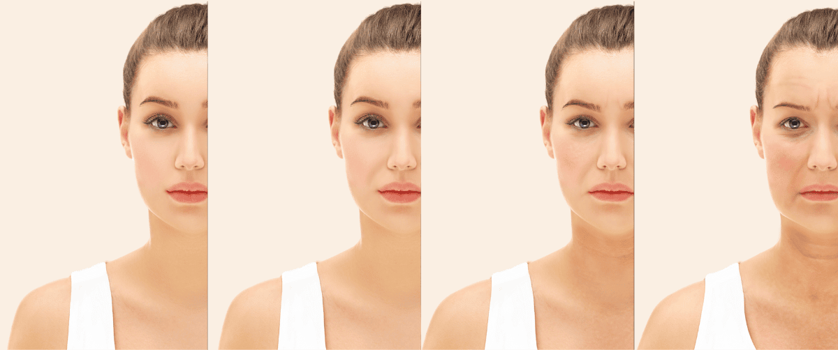 Aging Skin