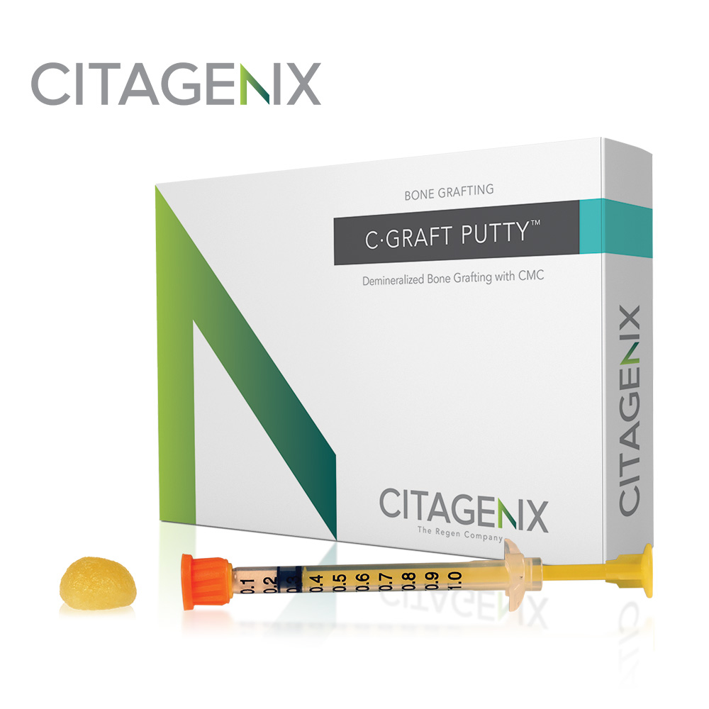 C-Graft Putty� C-Graft Putty�