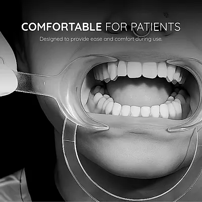 Cheek Retractor