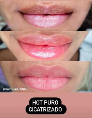 HOT 15ML