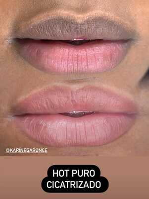 HOT 15ML