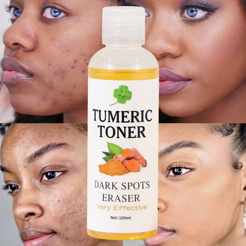 TUMERIC TONER DARK SPOT ERASER - 100ML TUMERIC TONER DARK SPOT ERASER - 100ML