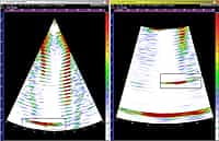 NM01X3A003 NM01X3A003