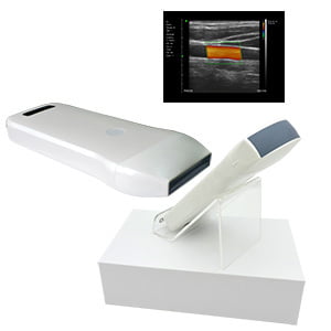 ULTRASONIDO WIFI COLOR DOPPLER ULTRASONIDO WIFI COLOR DOPPLER