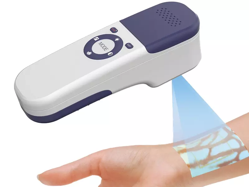 Vein Finder QV-500 Vein Finder QV-500
