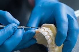 yeso dental kg yeso dental kg