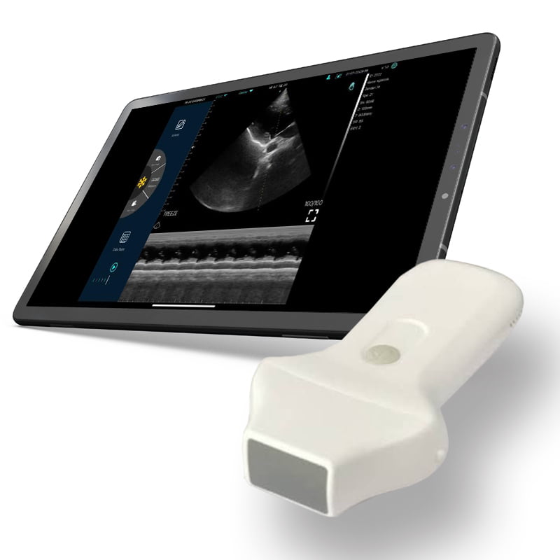 Ultrasonido Wifi Sectorial Cardiac Ultrasonido Wifi Sectorial Cardiac